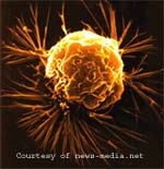 BREAST CANCER CELL