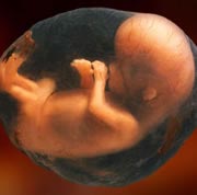 infant